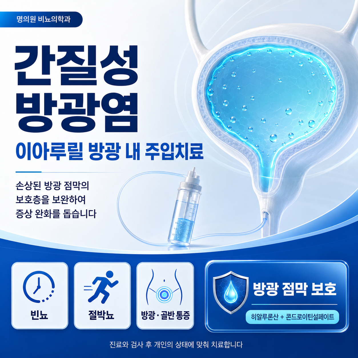 간질성 방광염 이아루릴 방광 내 주입치료를 안내하는 제공 그래픽