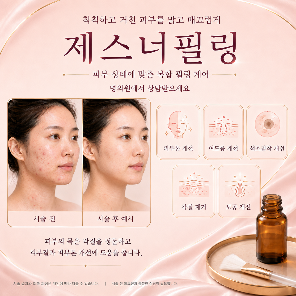 제스너 필링을 안내하는 제공 그래픽