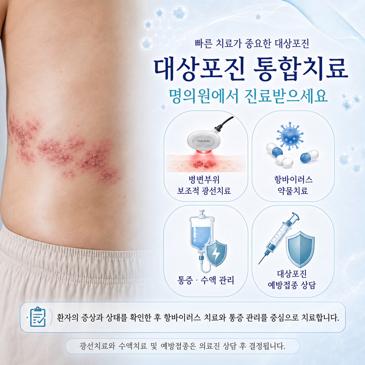대상포진 진단 및 치료를 안내하는 제공 그래픽